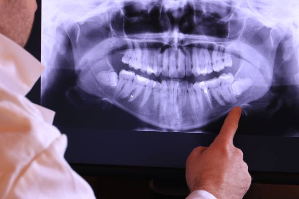 Best Pediatric Emergency Dentist in Chalco, NE